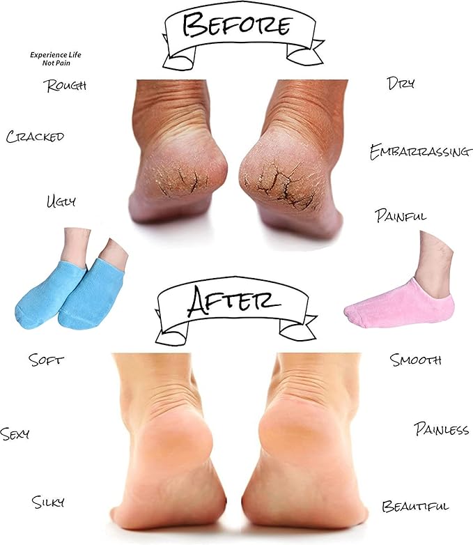 Spa Gel Socks Moisturizing And Repairing